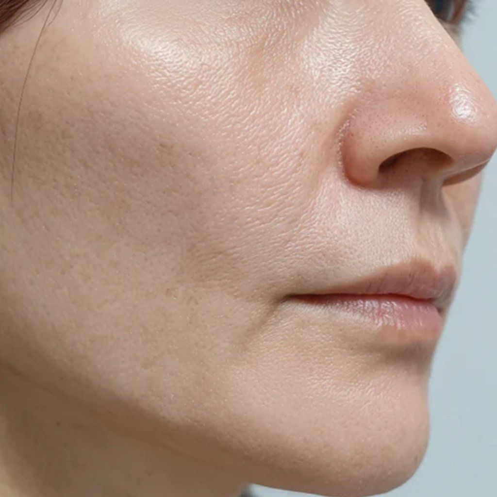 Piel después del tratamiento NAD+ Skin