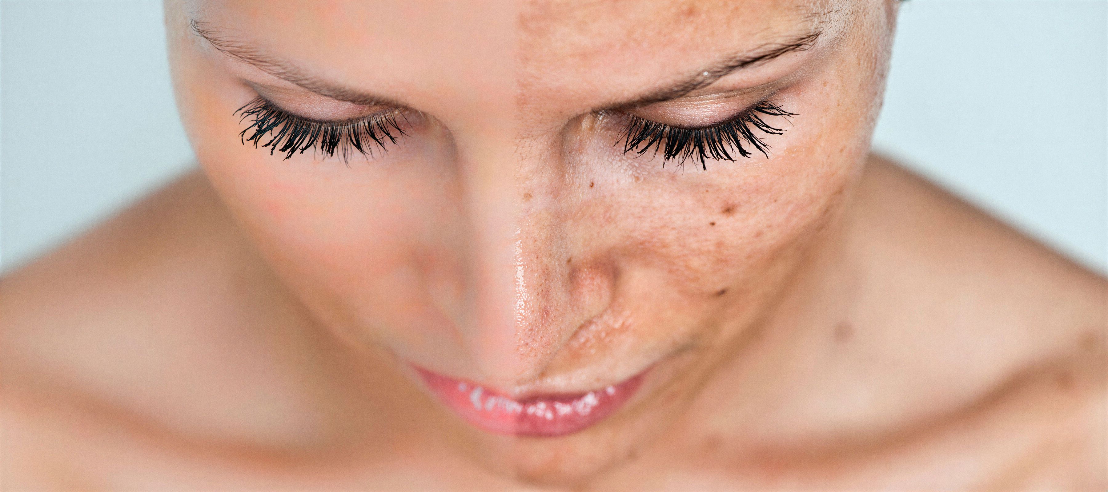 Piel facial antes y después del peeling
