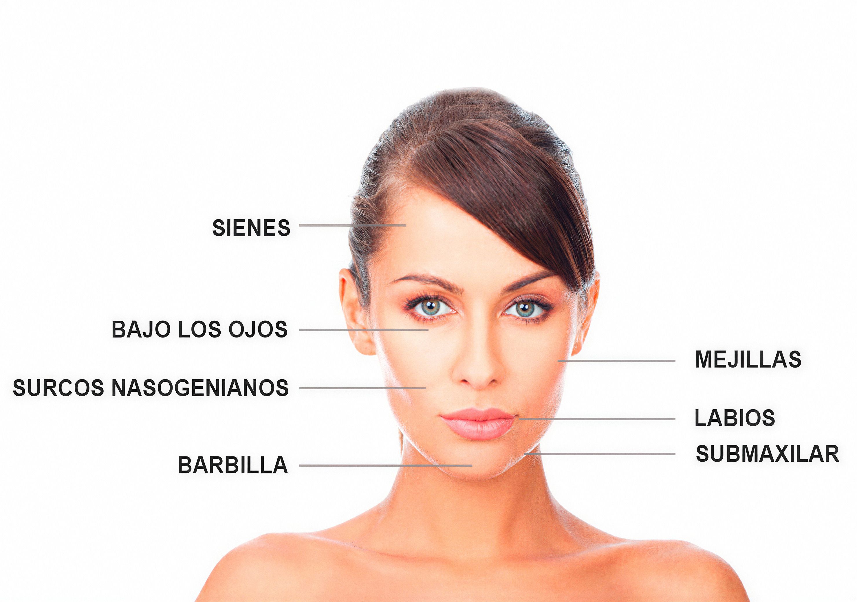 Zonas del rostro que trata el ácido hialurónico